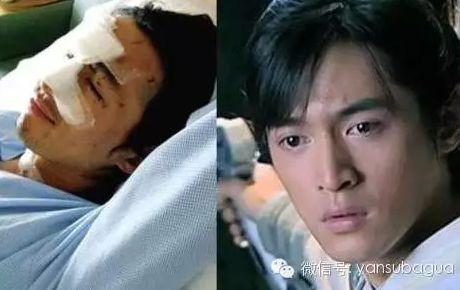 胡歌受伤前照片